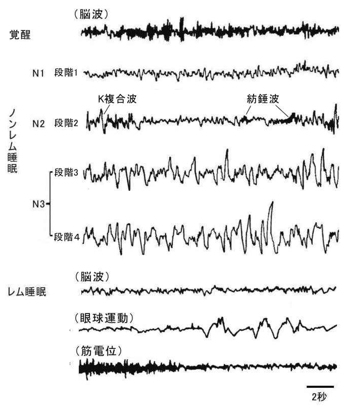 図1　覚醒・睡眠中の脳波、眼球運動、筋電位